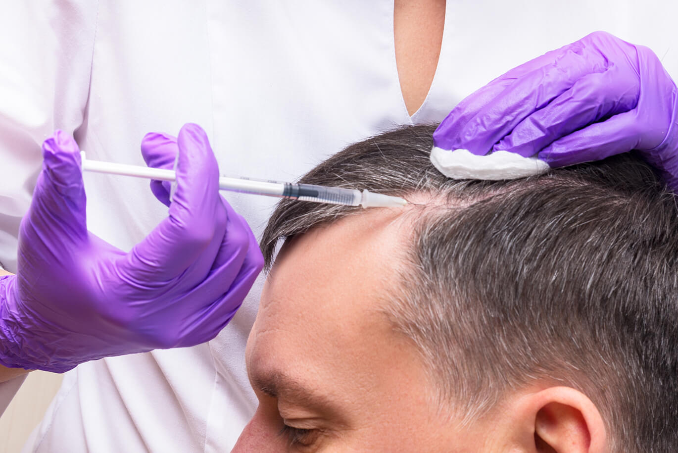 Hair Restoration Therapy Karachi